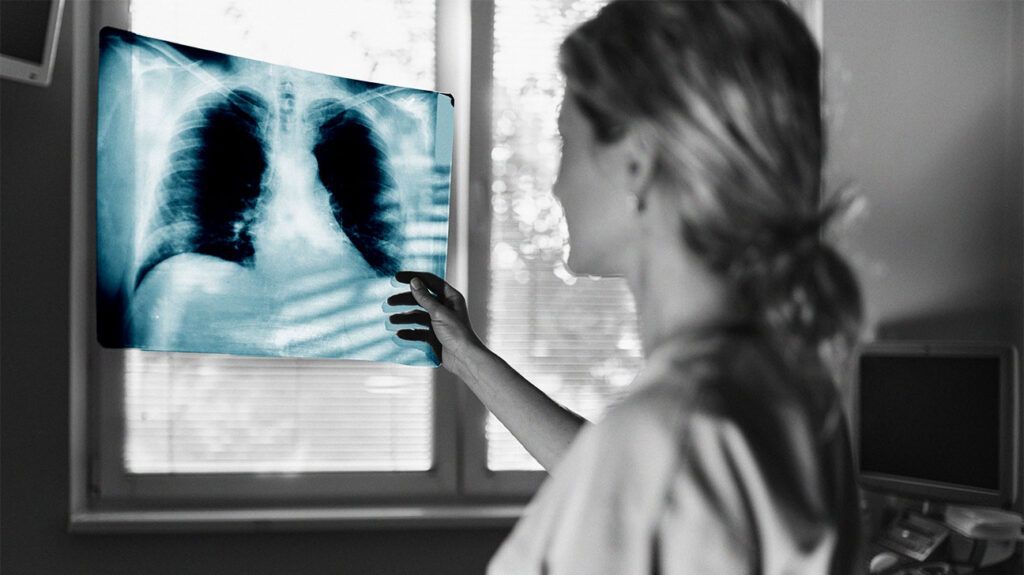 A person looking at an X-ray image of the chest-1