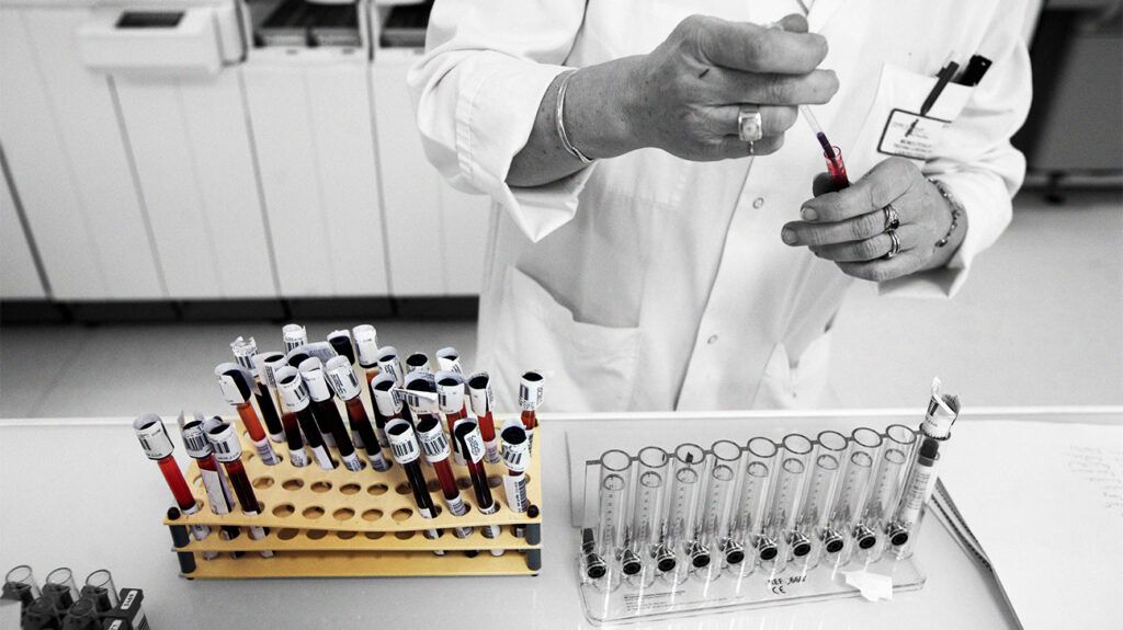 Blood sample containers on a laboratory table 1