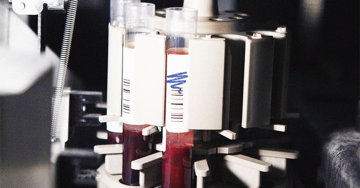 Blood test may detect ‘signatures’ to predict onset of 67 diseases