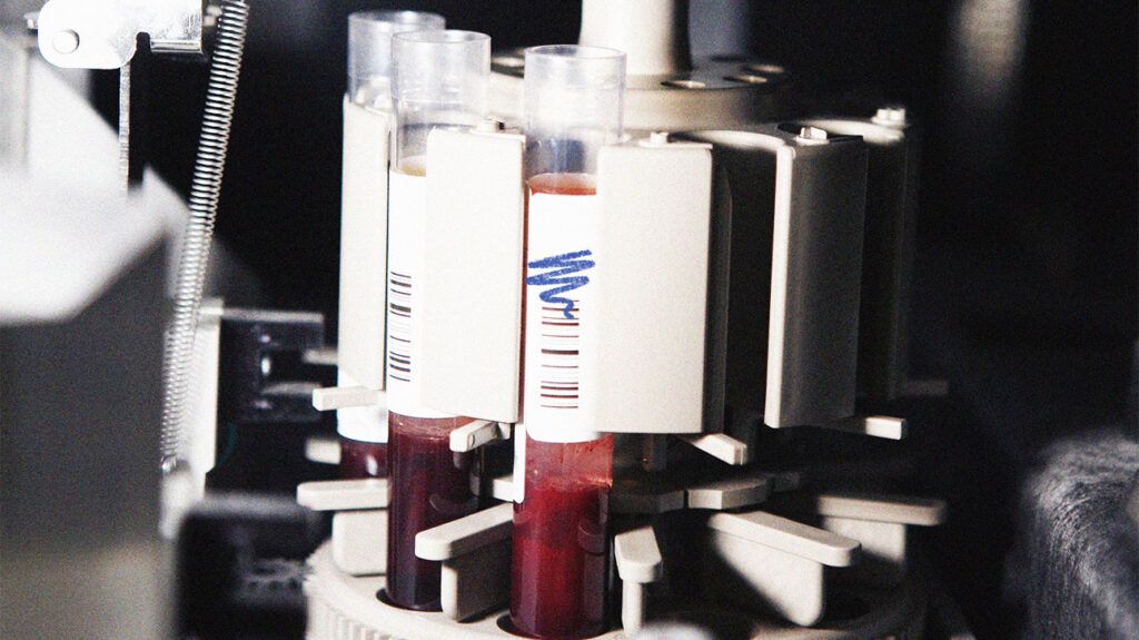 A close-up of a centrifuge used to separate blood samples