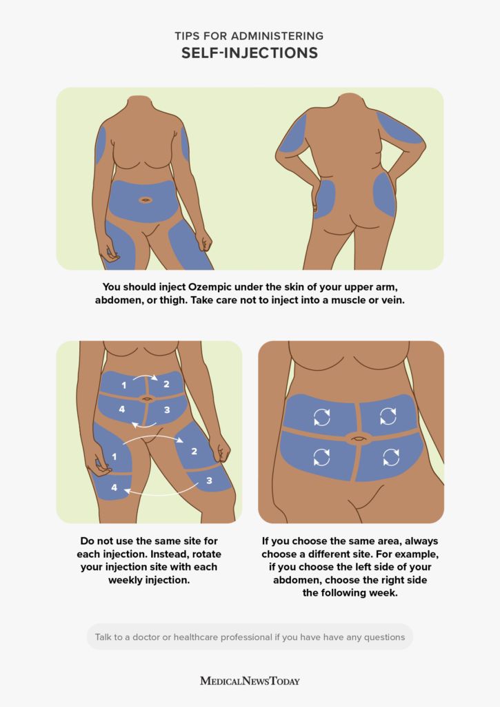 Illustration of how to administer Ozempic