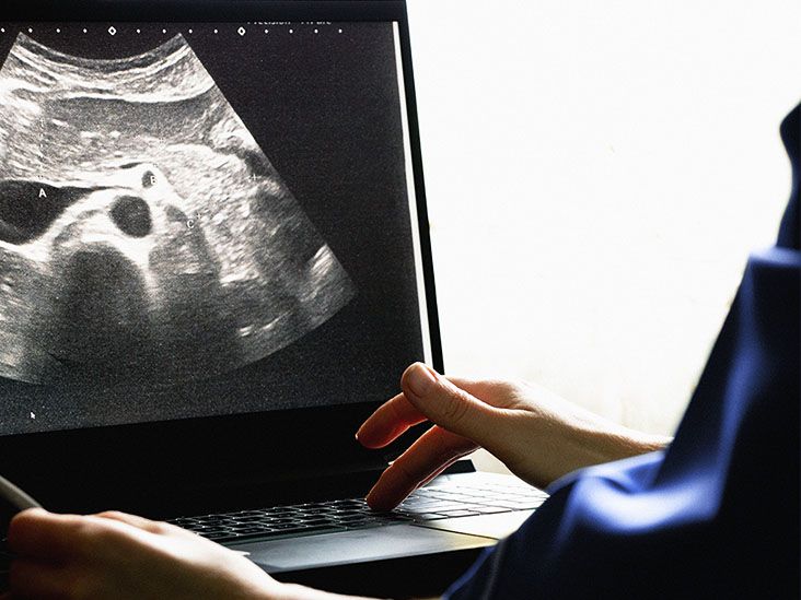 TCC kidney cancer: Symptoms, causes, treatment, and more