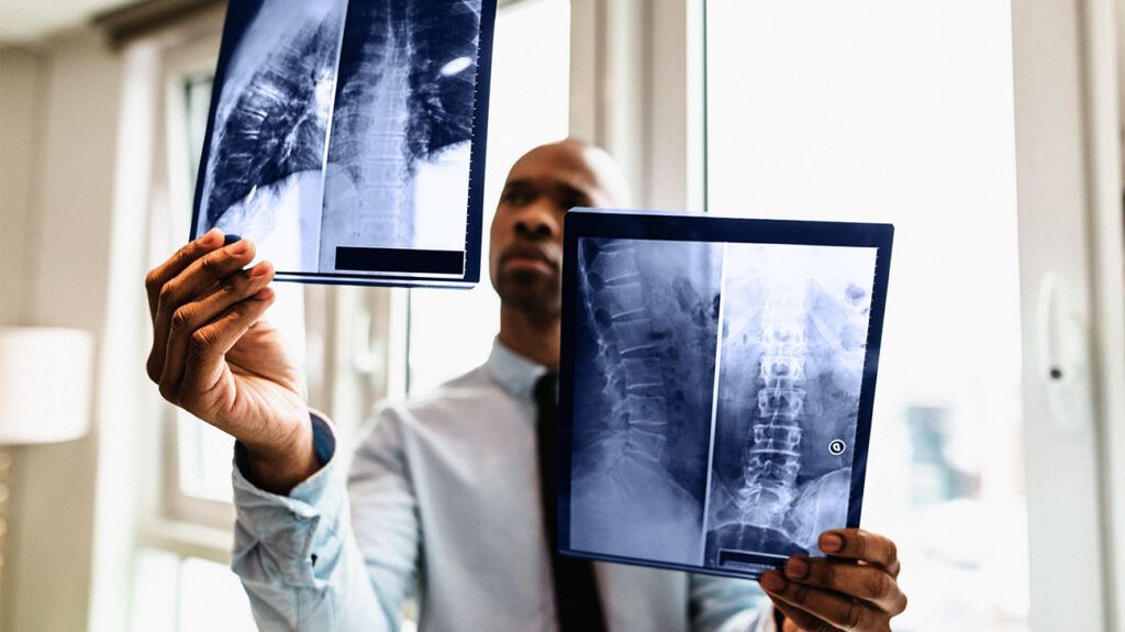 A doctor reading x-rays-2.