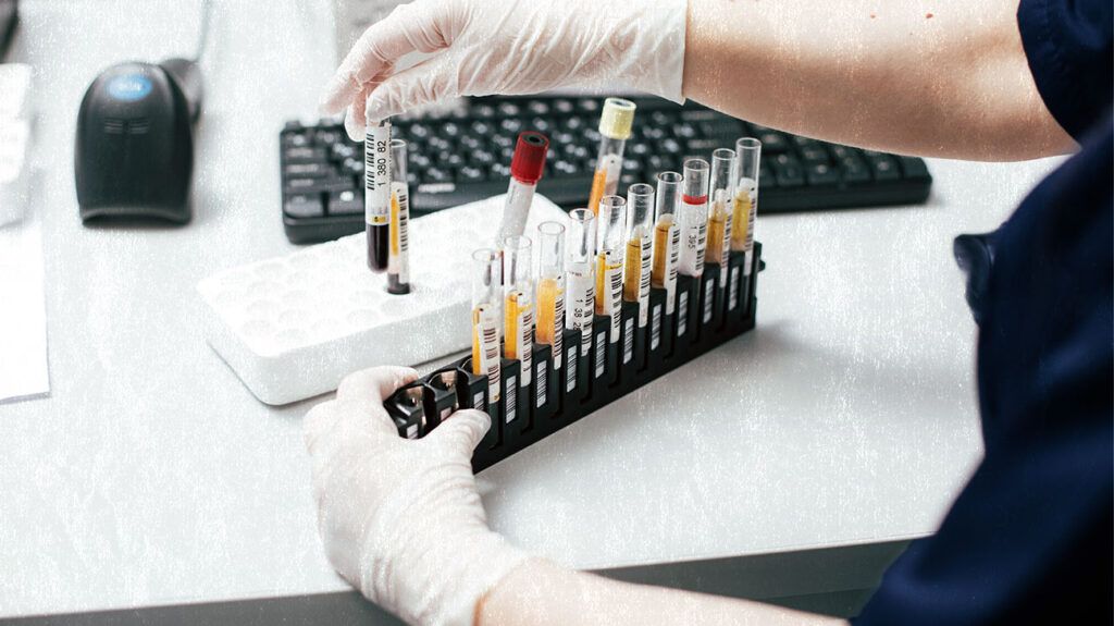 Scientist changing the rack of test tubes on the table