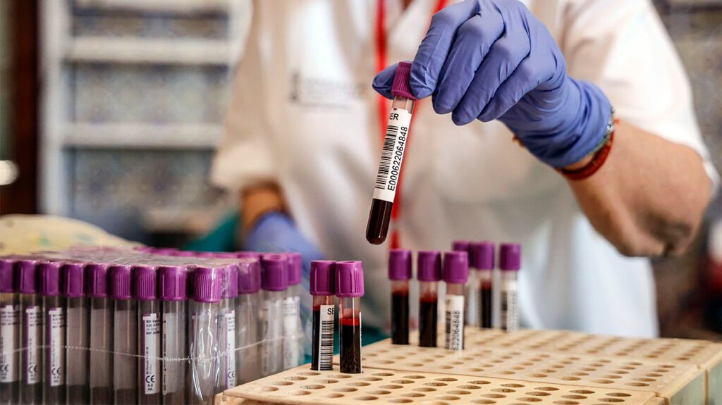 A lab professional placing test tubes of blood in a tray for assessment