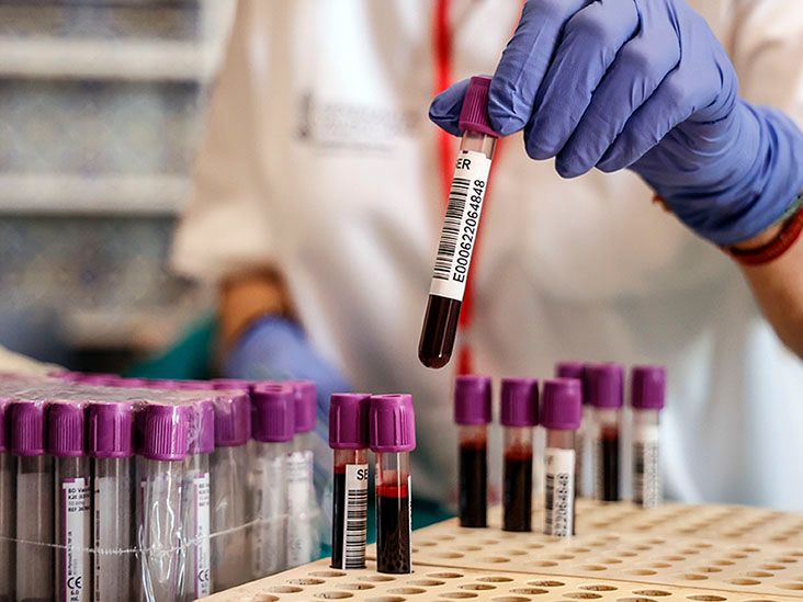 Alzheimer&rsquo;s: New blood test may help catch 90% of cases