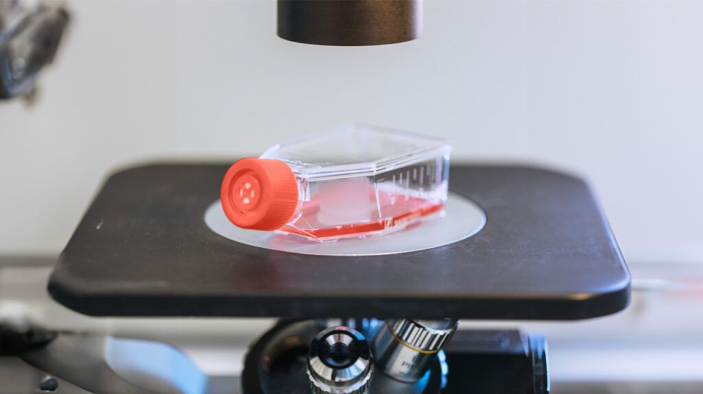 A blood test sample under a microscope as someone checks for HPV mRNA E6/E7.-1