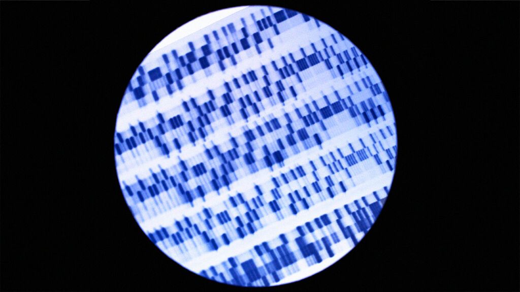 DNA through a microscope