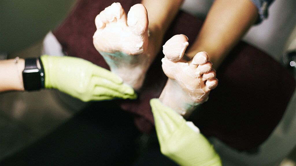 A person's hands in rubber gloves washing someone's feet, a common location for dyshidrotic eczema.