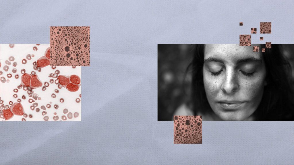 Collage of pictures including: blood cells and black & white image of a female with her eyes closed