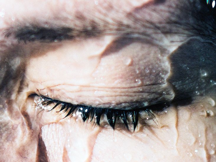 Curing eye stye hotsell