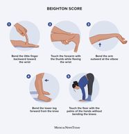 Beighton Score Test Results And What They Mean