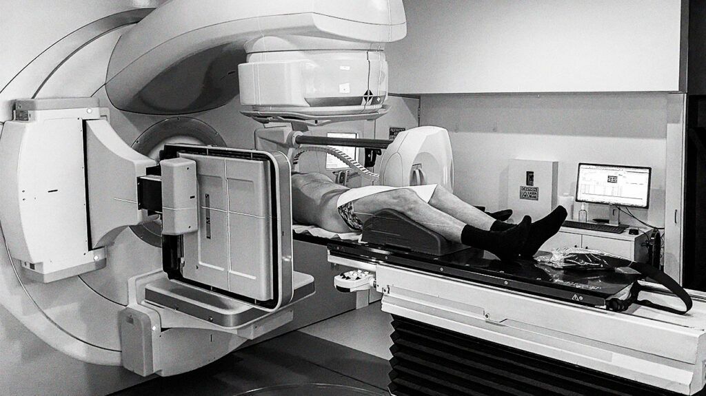 Black and white image of a person undergoing radiation treatment