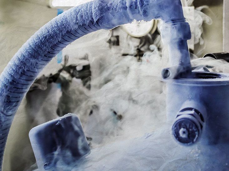 Cryotherapy on cervix: Side effects, aftercare, and more