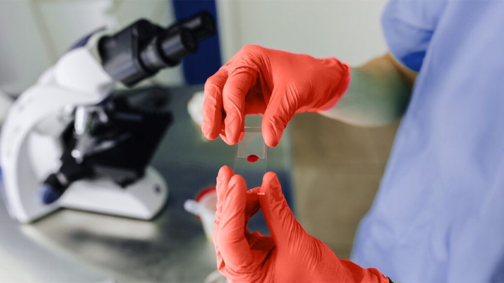A scientist preparing to look at a blood sample under a microscope-1.