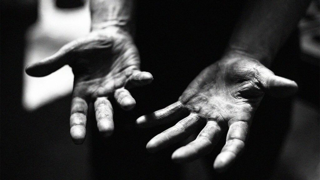 What is the race paradox in mental health?