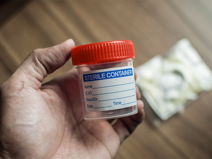 sterile-tub-for-poo-732x549-thumbnail.jp