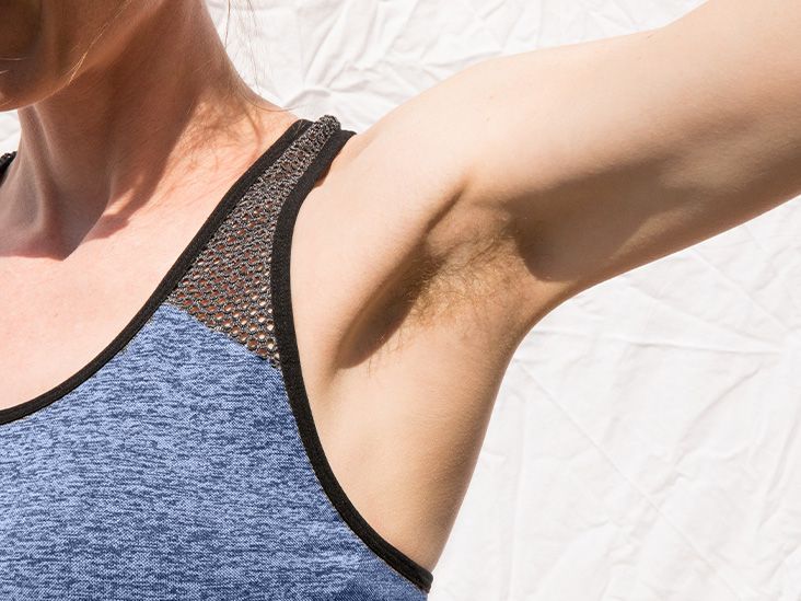 Is it possible to prevent hidradenitis suppurativa?