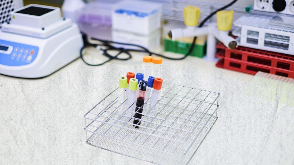 Tubes containing a blood sample ready for laboratory analysis