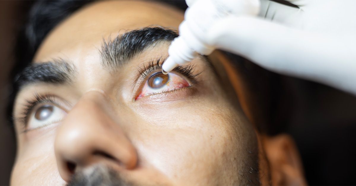 Pneumococcal conjunctivitis: Symptoms and how to treat them