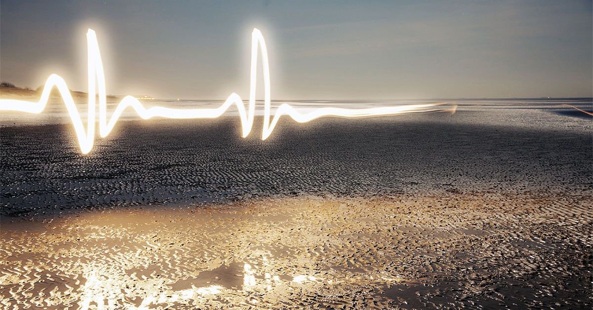 Heart rate variability: Clinical importance and measuring