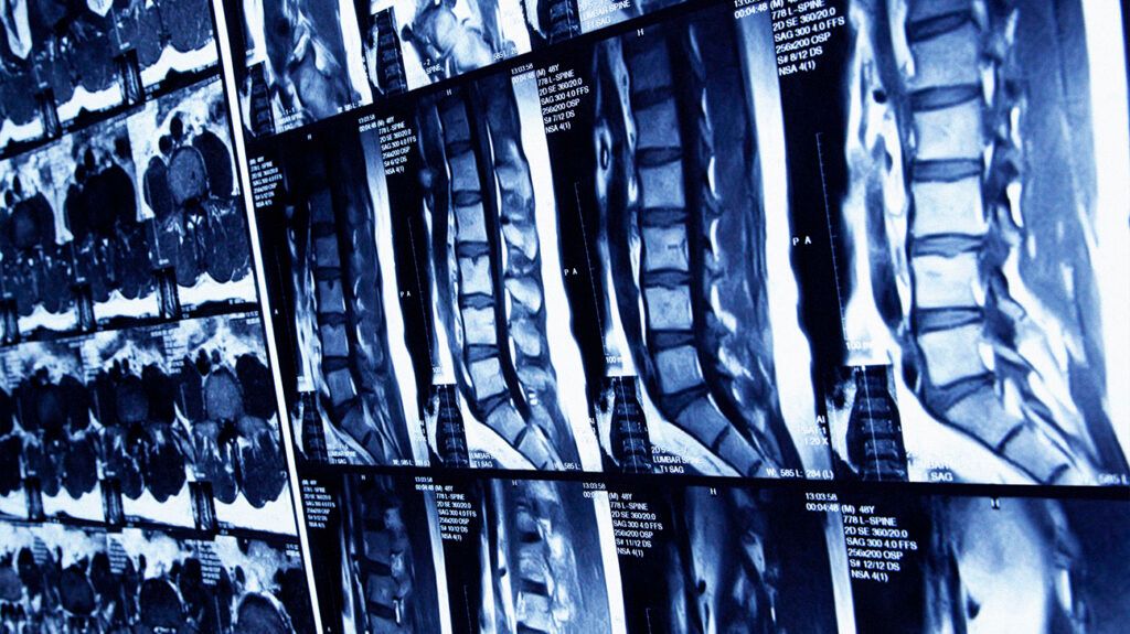 scan images of the spine-1