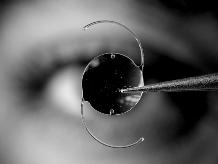 Extended depth of focus (EDOF): Benefits, risks, and more