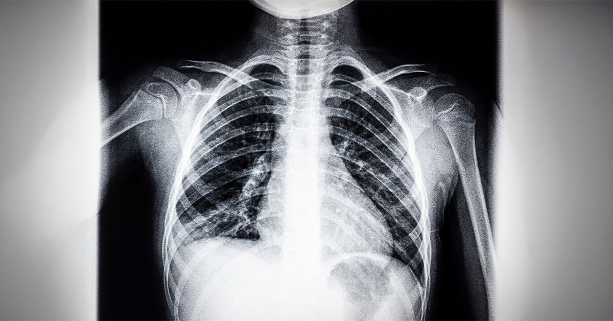 How many ribs do humans have? Men, women, and anatomy