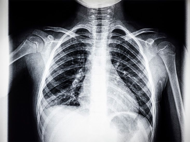 How many ribs do humans have? Men, women, and anatomy