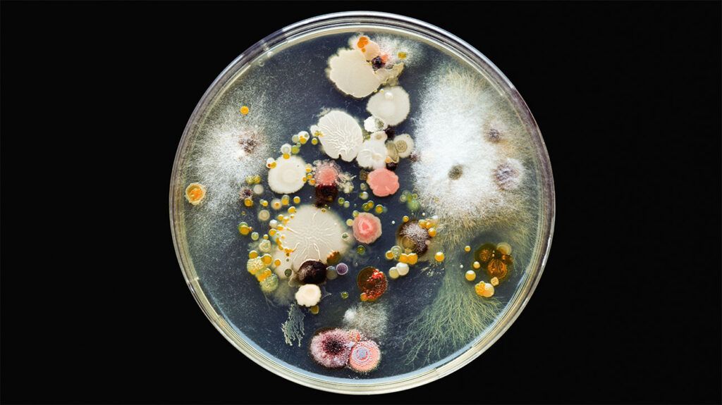 A petri dish filled with gel on which numerous species of fungi are growing in different colors.