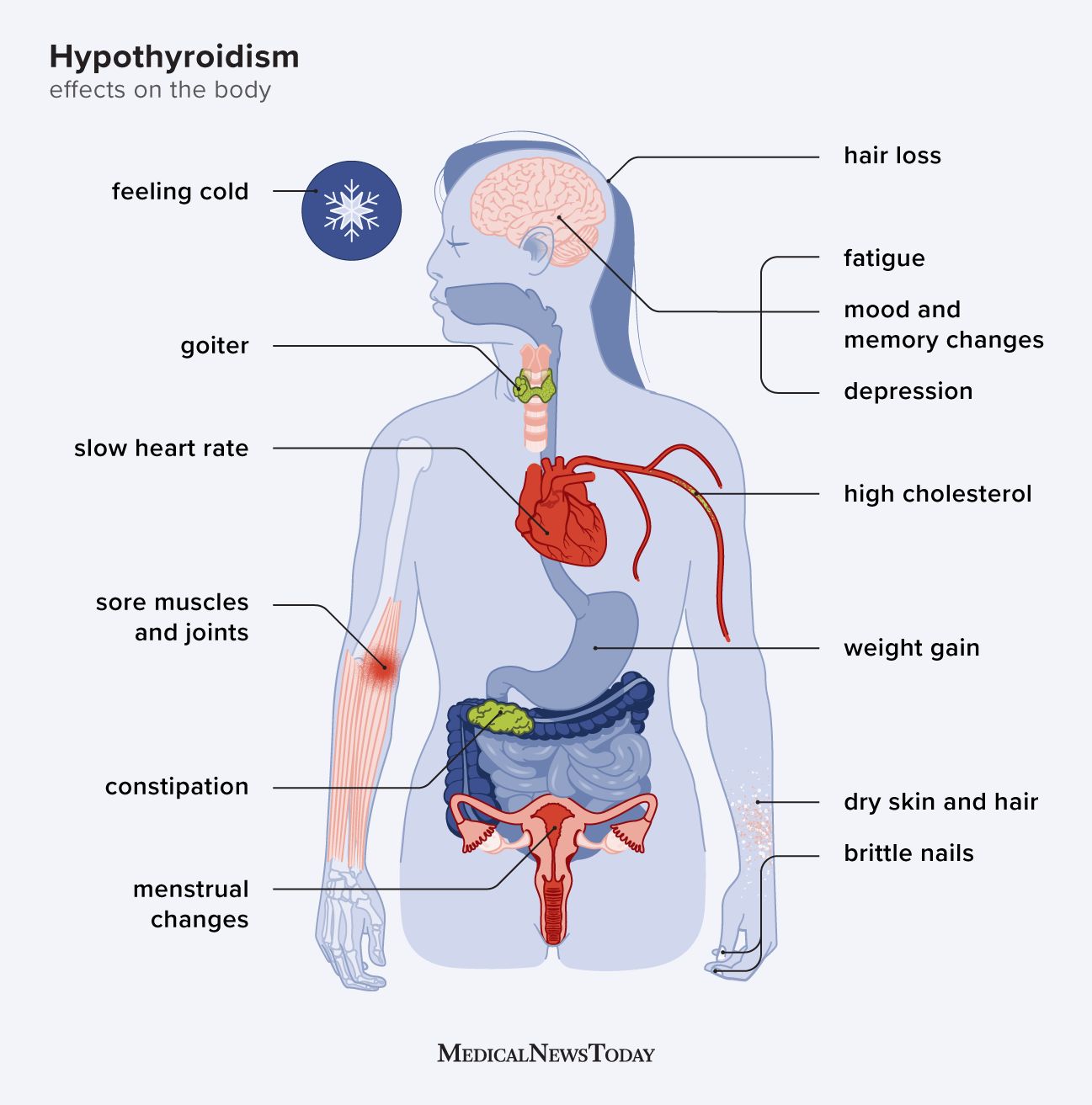 Symptoms of Hypothyroidism