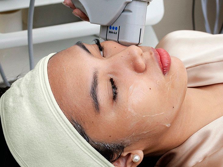 HIFU facial: What is it, how it works, effects, cost, and more