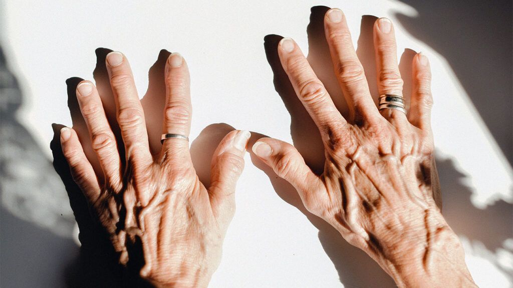 An older persons hands 1