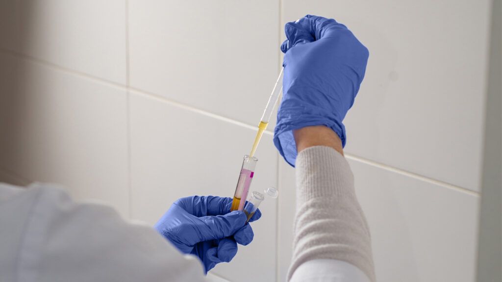 A person with gloved hands separating blood samples from a vial with a pipette