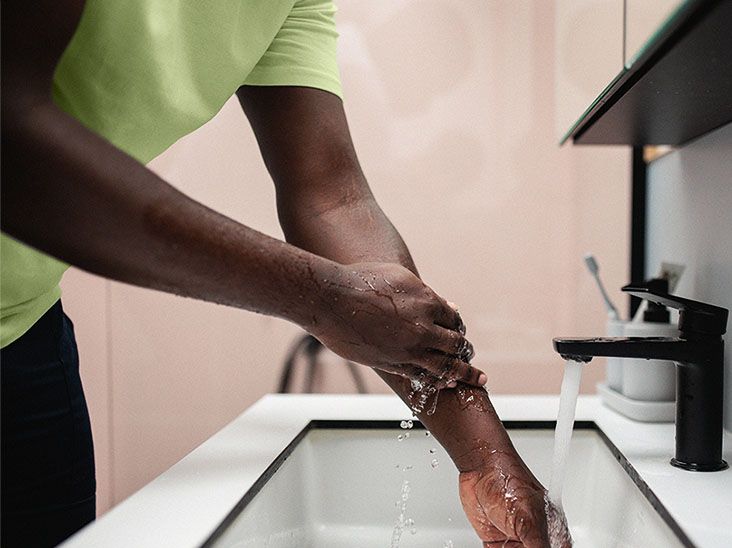 Should you pop a boil?