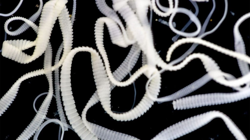 A white tapeworm against a black background.-2