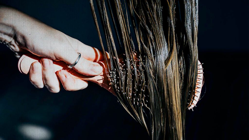 Scalp psoriasis and hair loss: What is the connection?