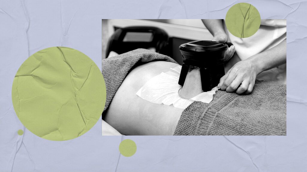 A cool sculpting device being used on a persons abdomen