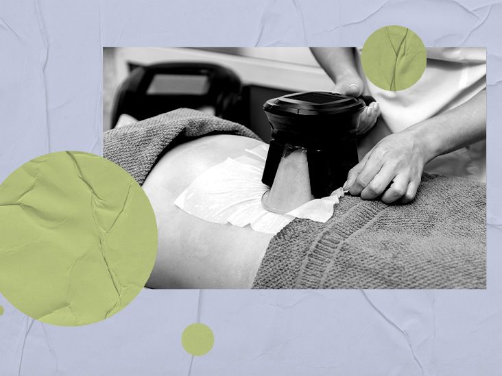 Can You Do Cool Sculpting at Home: Expert Insights