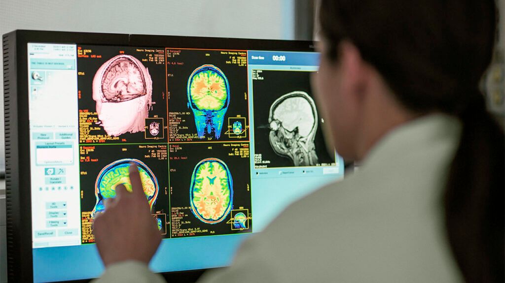 A doctor looking at MRI scans-2.