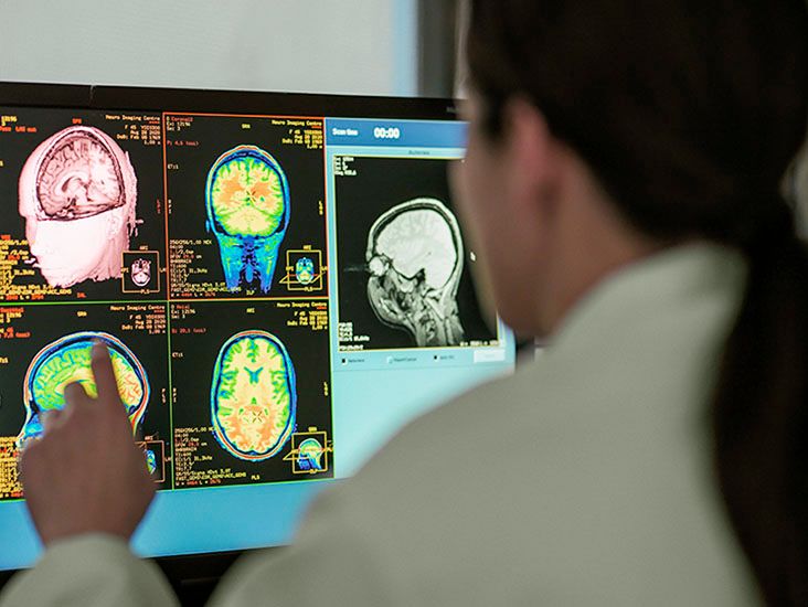 Huntington’s disease affects muscle as well as brain