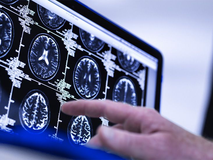 Could a single brain scan predict the risk of age-related conditions like dementia?