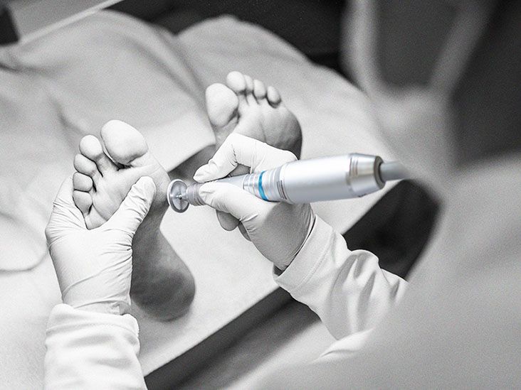 What is a medical pedicure, and what does it involve?
