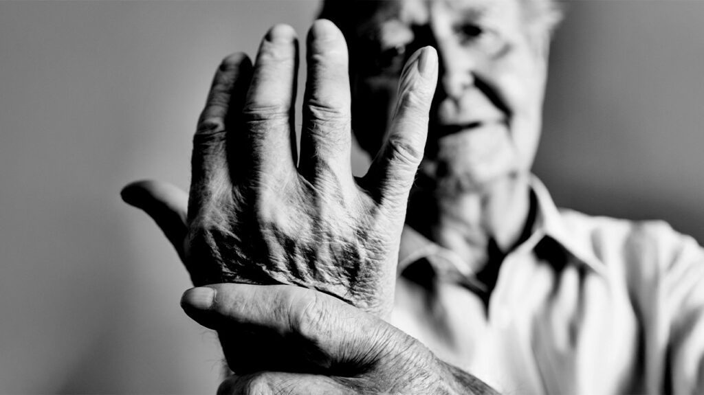 Innovative Test Aims to Personalize Rheumatoid Arthritis Treatment with Predictive Biologics