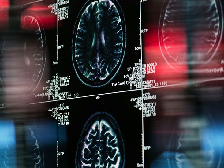 What is the purpose of the ventricles of the brain?