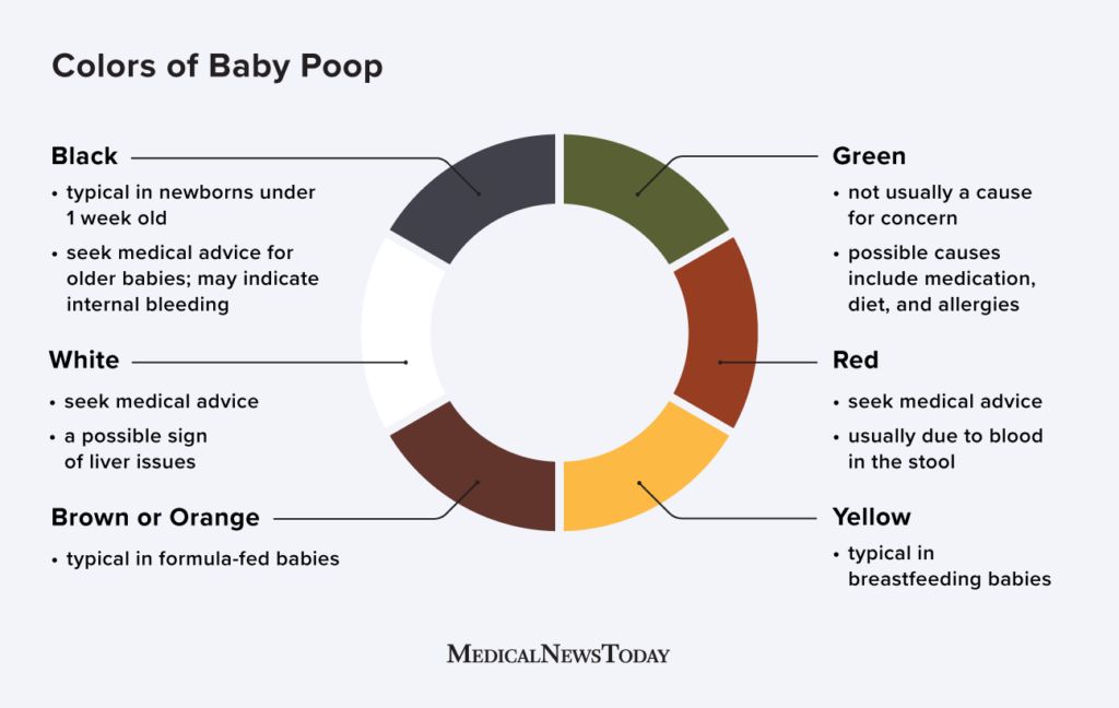 Infographic detailing different colors of stool and their possible causes in infants