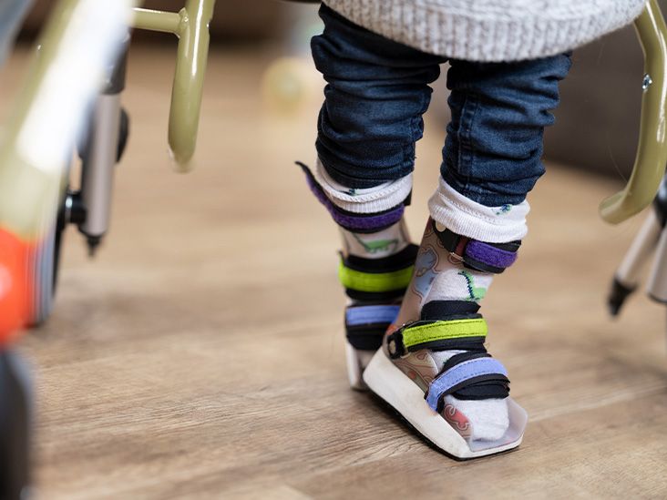 What to know about Duchenne and Becker muscular dystrophy (DMD/BMD)