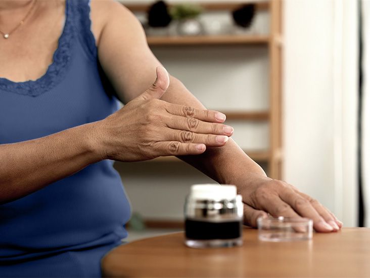 What to know about molluscum contagiosum