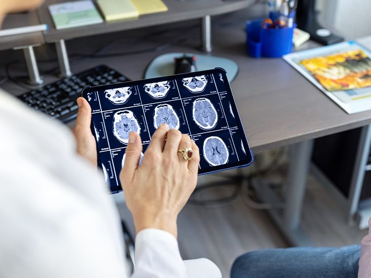 What to know about pineal cysts