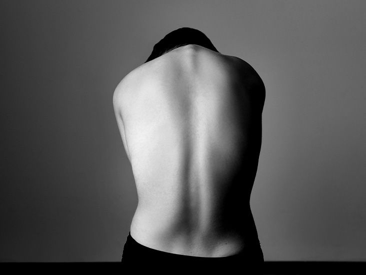 What causes a hot back?
